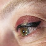 علت کبودی چشم بعد از تاتو خط چشم چیست؟