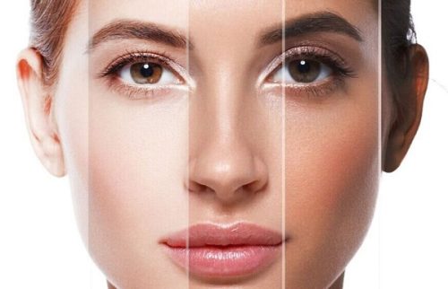 میکروبلیدینگ برای پوستهای چرب