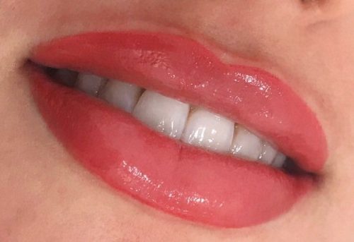 مراقبت های بعد از شیدینگ لب