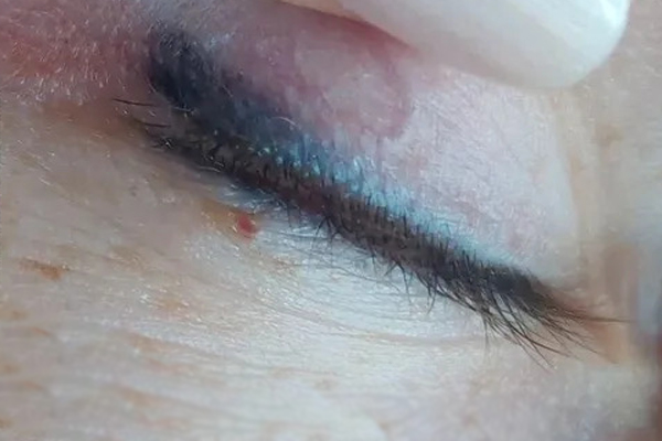 علت ابی شدن تاتو خط چشم