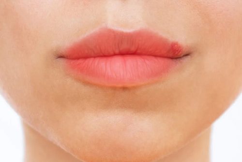 چرا بعد از تاتو لب تبخال می زنیم