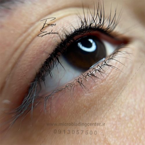 آیا بن مژه باعث ریزش مژه میشود