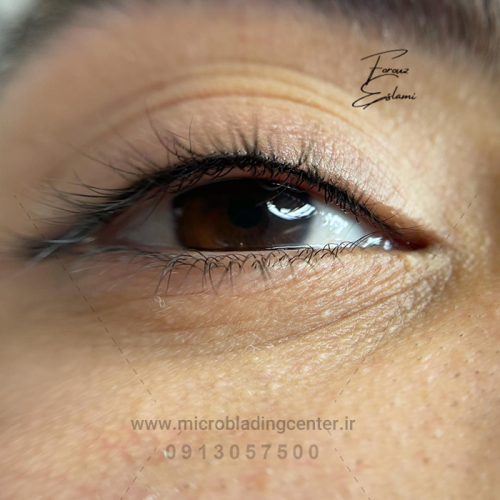 آیا بن مژه باعث ریزش مژه میشود